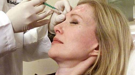 some neurotoxins and fillers are better suited to specific areas of the face like the cheeks vs. brow